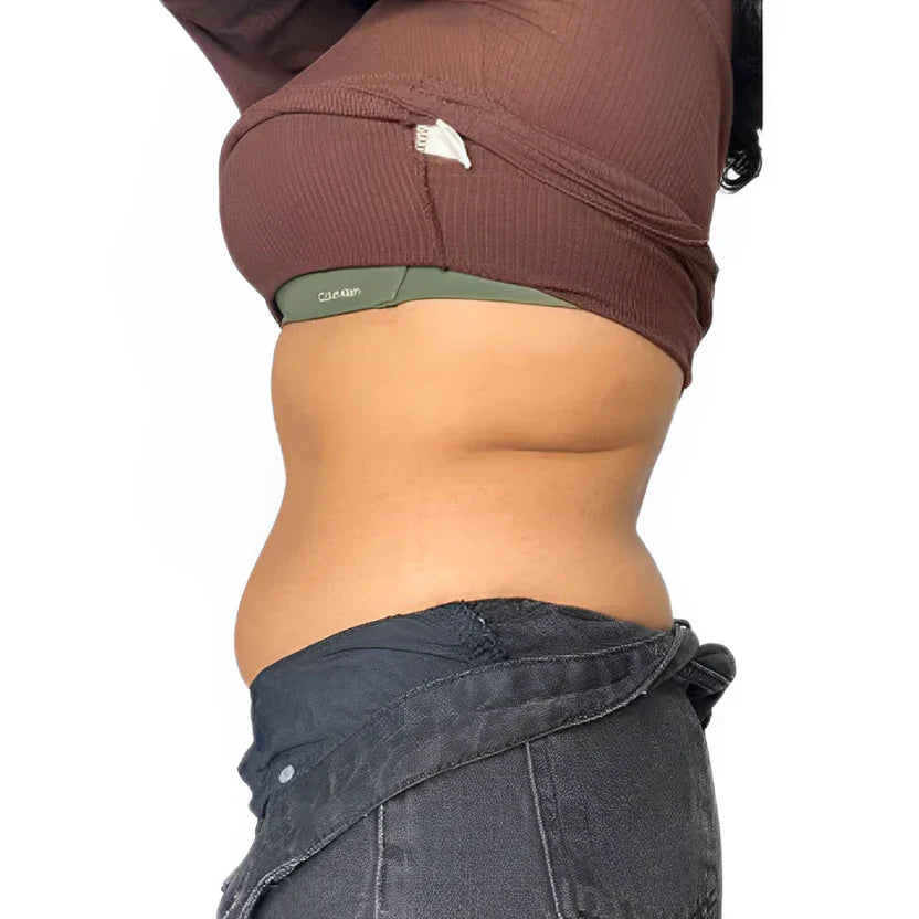 Before wearing shapewear - natural body shape